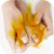 Diabetic Neuropathy- Burning sensation in feet Diabetic Neuropathy